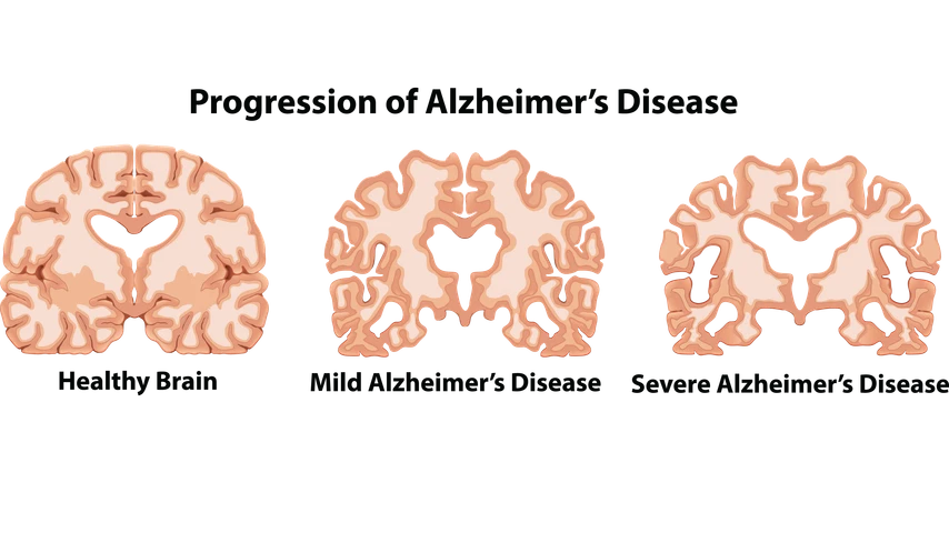 An Anatomy of Human Brain illustration